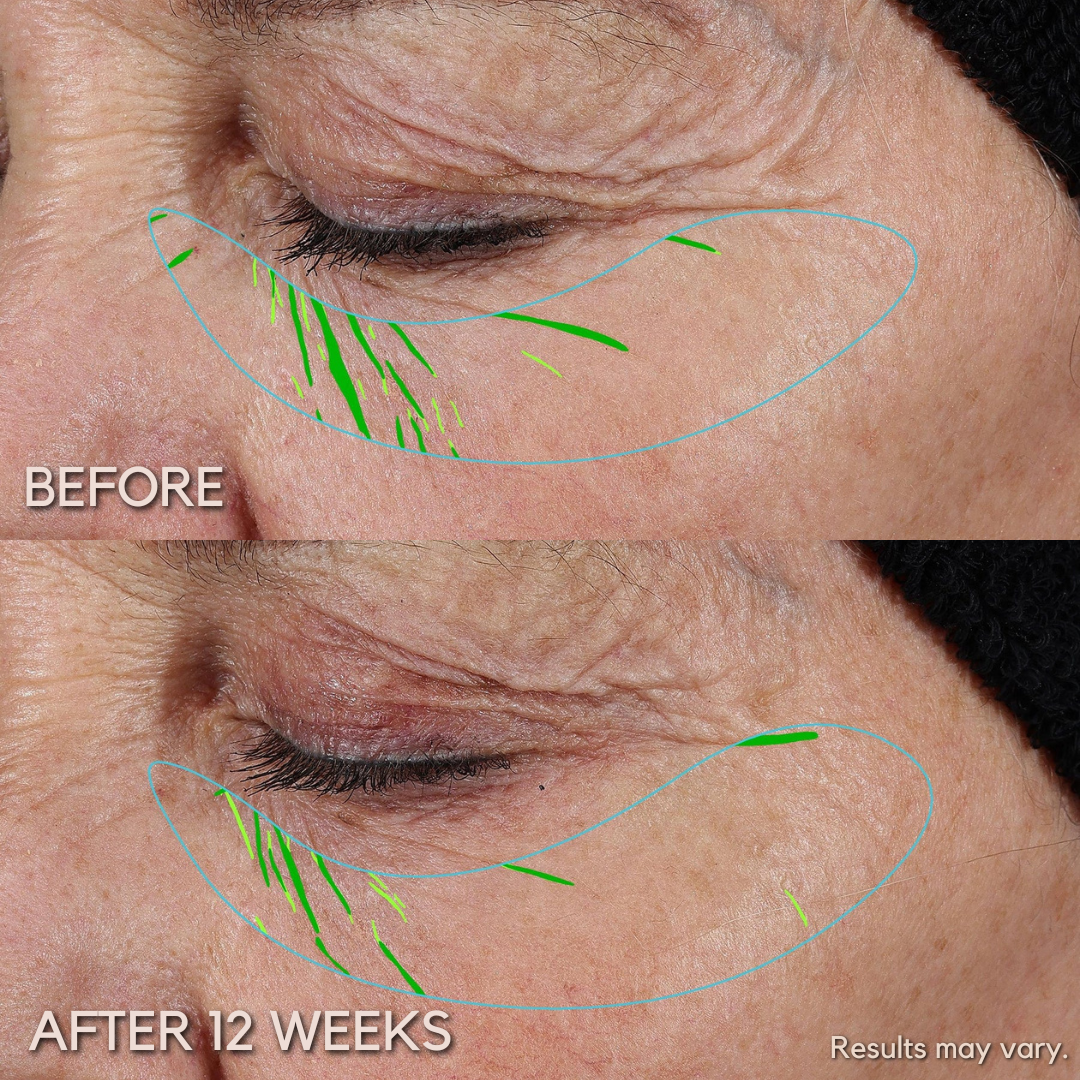 Needleless™ Growth Factor Serum